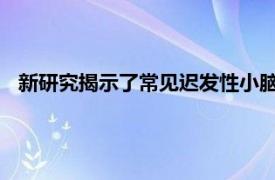 新研究揭示了常見遲發性小腦性共濟失調背后隱藏的遺傳異常