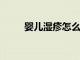 嬰兒濕疹怎么正確的去根方式來(lái)了