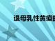退母乳性黃疸的方法都有哪些知道嗎