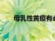母乳性黃疸有必要斷奶嗎原因是什么