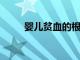 嬰兒貧血的根本原因有哪些呢分享