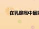 在乳腺癌中最好的防御是強大的進攻