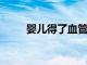 嬰兒得了血管瘤怎么辦如何解決呢