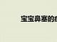 寶寶鼻塞的癥狀都有哪些呢分享