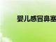 嬰兒感冒鼻塞怎么辦如何有效解決